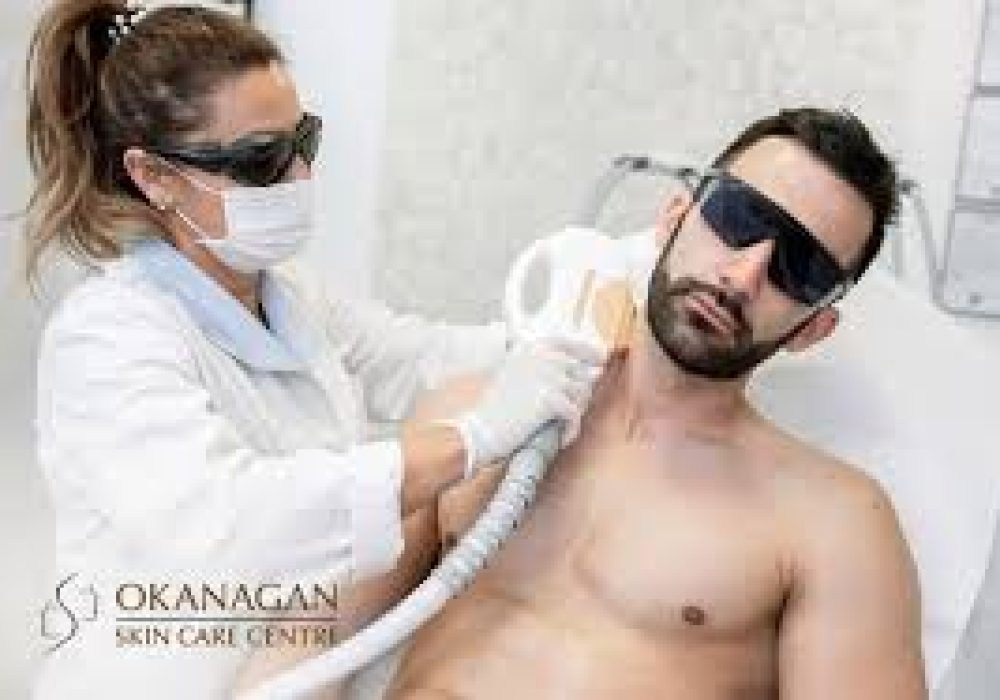 Beard shaping (Laser hair reduction)
